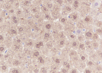 SETBP1 Recombinant Rabbit Monoclonal Antibody