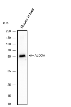 ACVR1B Recombinant Rabbit Monoclonal Antibody