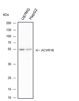 ACVR1B Recombinant Rabbit Monoclonal Antibody