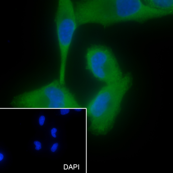 MSK1 Recombinant Mouse Monoclonal Antibody