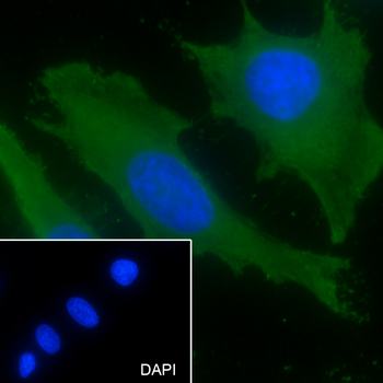 KIF20A Recombinant Mouse Monoclonal Antibody