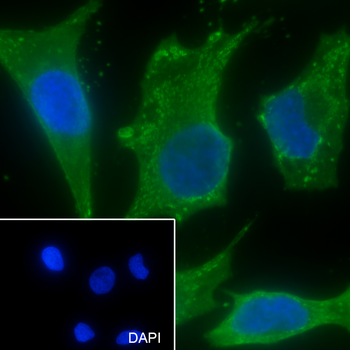 CAPG Recombinant Mouse Monoclonal Antibody