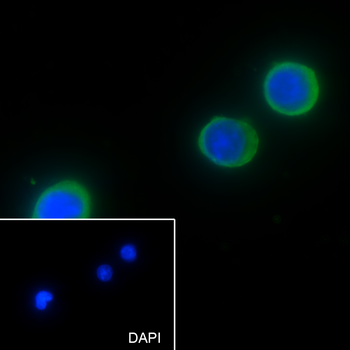 MTHFD1 Recombinant Mouse Monoclonal Antibody