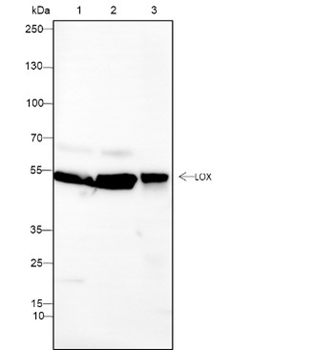 LOX Recombinant Rabbit Monoclonal Antibody