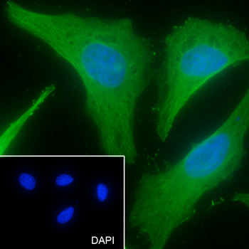 LOX Recombinant Rabbit Monoclonal Antibody