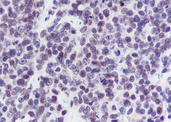 DCPS Recombinant Mouse Monoclonal Antibody