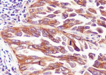 Integin alpha 3 Recombinant Mouse Monoclonal Antibody