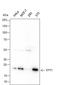 TPT1 Recombinant Mouse Monoclonal Antibody