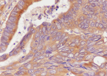 TPT1 Recombinant Mouse Monoclonal Antibody
