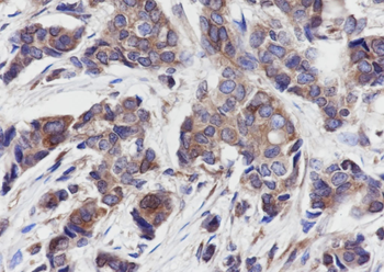 Calpastatin Recombinant Rabbit Monoclonal Antibody