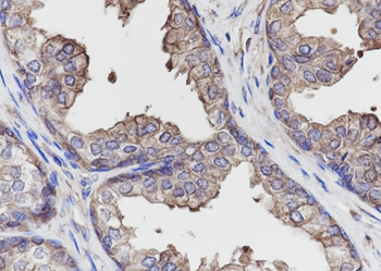 Calpastatin Recombinant Rabbit Monoclonal Antibody