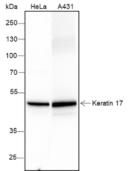 Keratin 17 Recombinant Rabbit Monoclonal Antibody