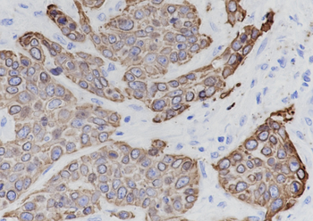 Keratin 17 Recombinant Rabbit Monoclonal Antibody