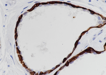 Keratin 17 Recombinant Rabbit Monoclonal Antibody