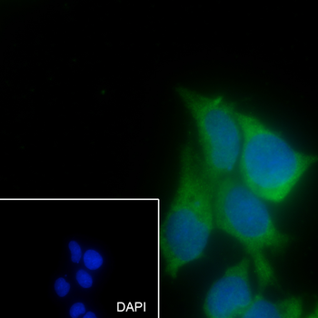 Laminin B1 Recombinant Rabbit Monoclonal Antibody