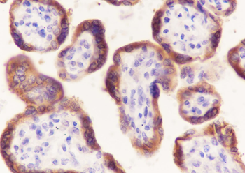 Laminin B1 Recombinant Rabbit Monoclonal Antibody