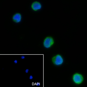 LY75 Recombinant Rabbit Monoclonal Antibody