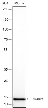 CRABP2 Recombinant Mouse Monoclonal Antibody