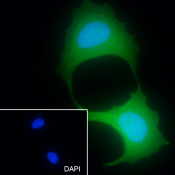 CRABP2 Recombinant Mouse Monoclonal Antibody