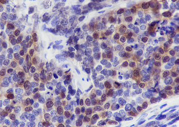 CRABP2 Recombinant Mouse Monoclonal Antibody