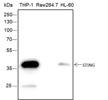 STING1 Recombinant Rabbit Monoclonal Antibody