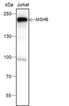 MSH6 Recombinant Mouse Monoclonal Antibody