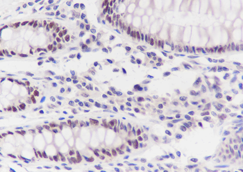 MSH6 Recombinant Mouse Monoclonal Antibody