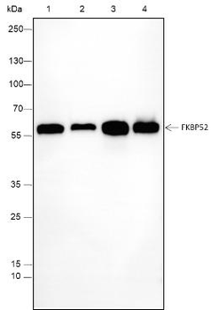 FKBP52 Recombinant Mouse Monoclonal Antibody