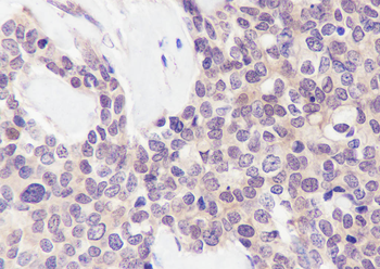 FKBP52 Recombinant Mouse Monoclonal Antibody