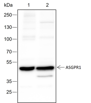 ASGPR Recombinant Rabbit Monoclonal Antibody