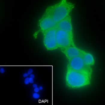 ASGPR Recombinant Rabbit Monoclonal Antibody