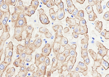 ASGPR Recombinant Rabbit Monoclonal Antibody