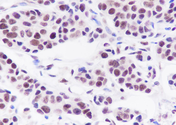 TFEB Recombinant Rabbit Monoclonal Antibody