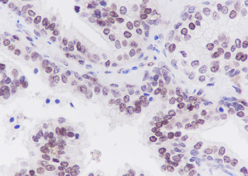 TFEB Recombinant Rabbit Monoclonal Antibody