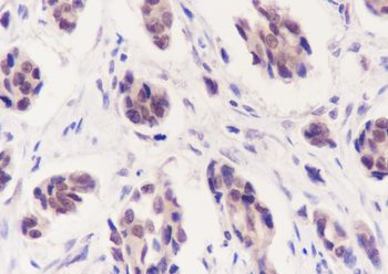 CDK8 Recombinant Rabbit Monoclonal Antibody