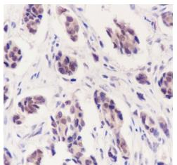 CDK8 Recombinant Rabbit Monoclonal Antibody