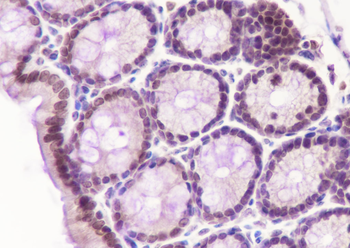 CDK8 Recombinant Rabbit Monoclonal Antibody