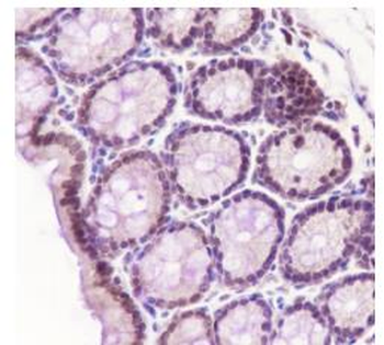 CDK8 Recombinant Rabbit Monoclonal Antibody