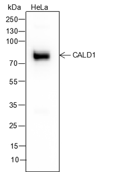 Caldesmon Recombinant Mouse Monoclonal Antibody