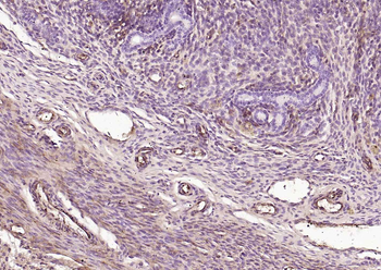 Caldesmon Recombinant Mouse Monoclonal Antibody