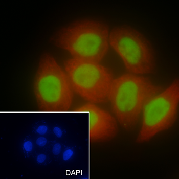 ANP32B Recombinant Mouse Monoclonal Antibody
