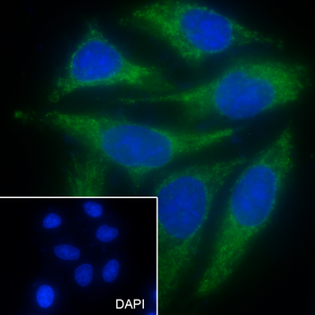 PDHE1 Recombinant Mouse Monoclonal Antibody