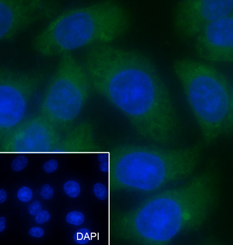 MDH1 Recombinant Mouse Monoclonal Antibody