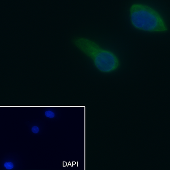 Dicer Recombinant Mouse Monoclonal Antibody