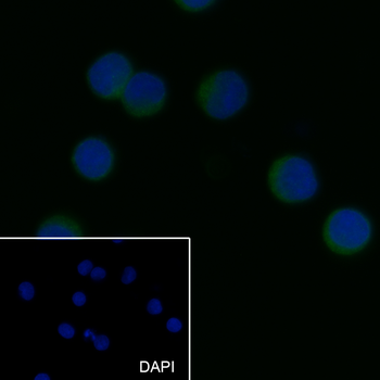 PRDM1 Recombinant Mouse Monoclonal Antibody