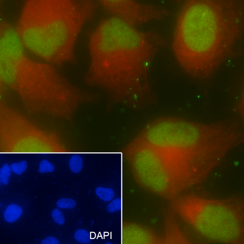 SMARCA5 Recombinant Mouse Monoclonal Antibody