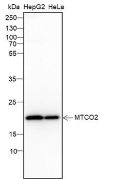 MTCO2 Recombinant Mouse Monoclonal Antibody
