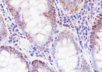 MTCO2 Recombinant Mouse Monoclonal Antibody