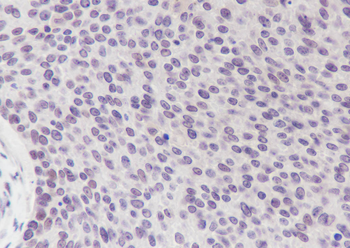 Cyclin D3 Recombinant Rabbit Monoclonal Antibody