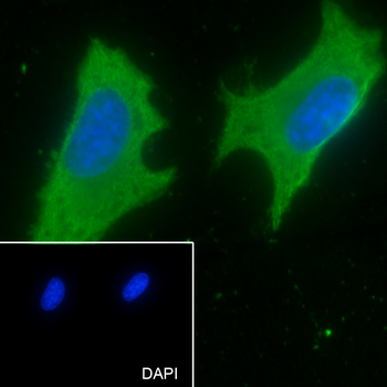 G3BP1 Recombinant Mouse Monoclonal Antibody